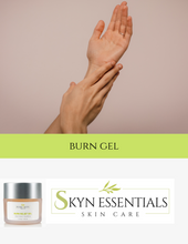 Load image into Gallery viewer, BURN RELIEF GEL