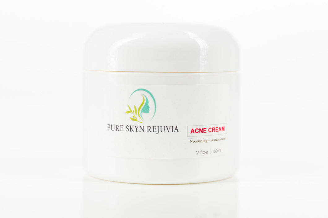 ACNE CREAM