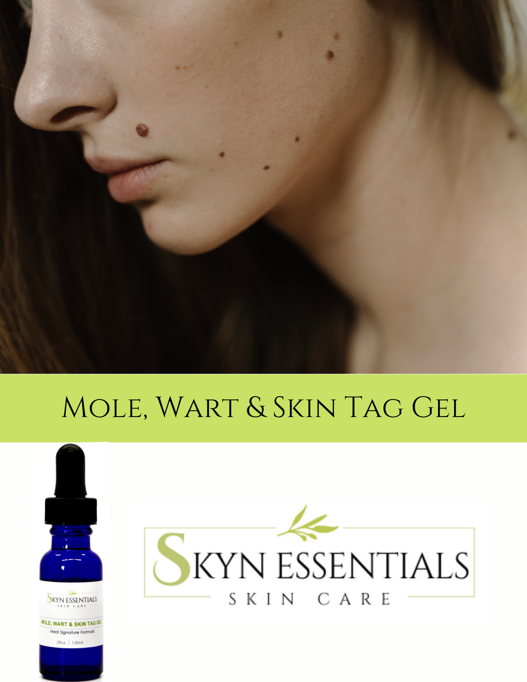 MOLE/WART/SKIN TAG GEL